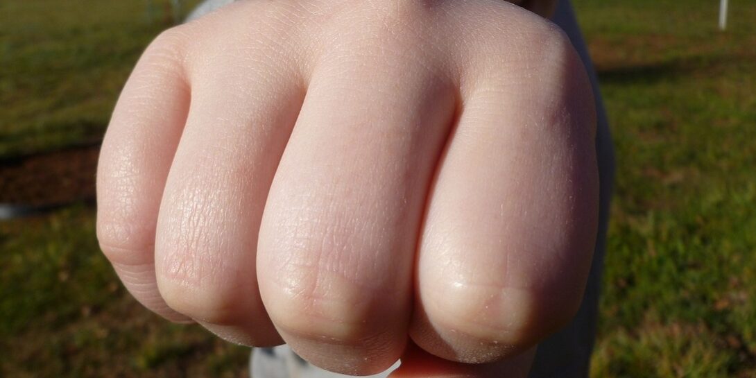 Assault and Battery Lawyer San Diego