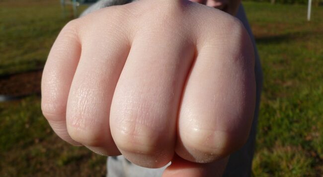 Assault and Battery Lawyer San Diego