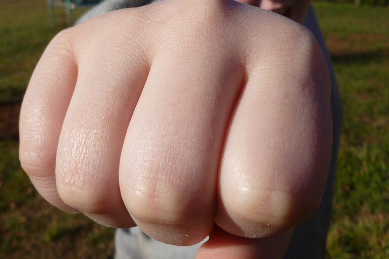 Assault and Battery Lawyer San Diego