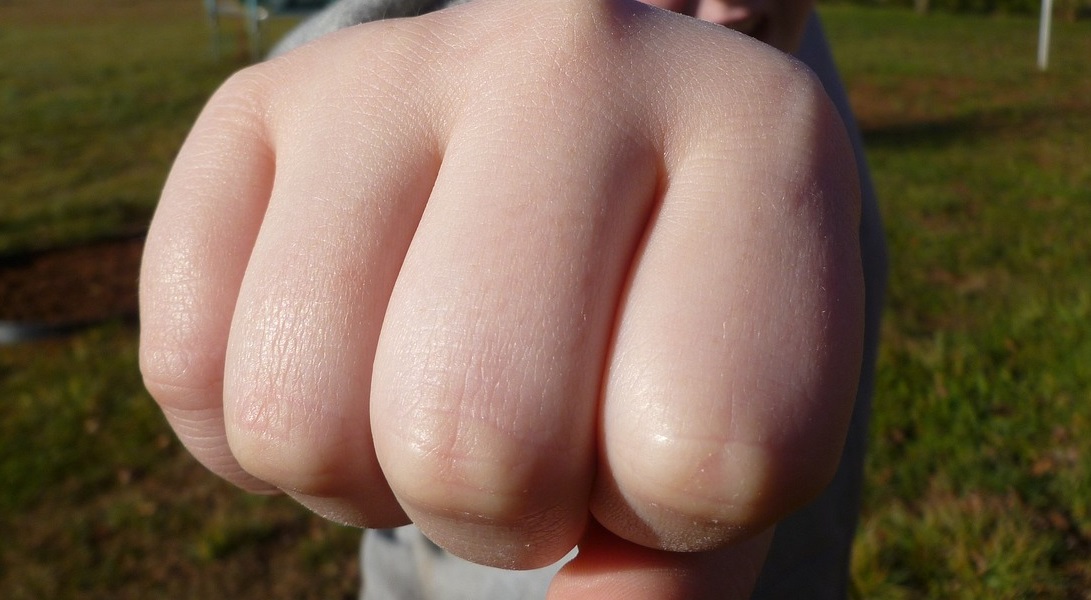 Assault and Battery Lawyer San Diego